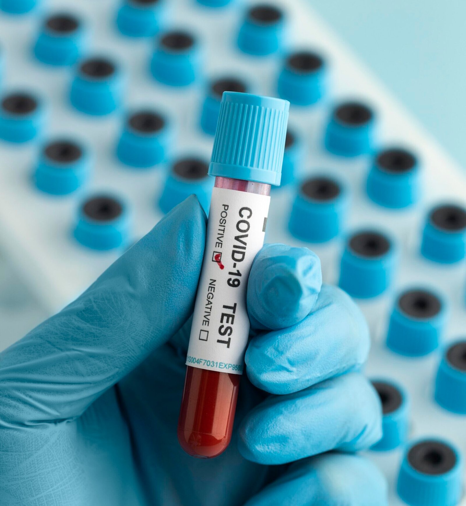 hand-with-protective-gloves-holding-blood-sample-covid-test